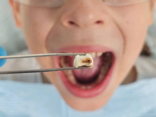 Best Emergency Gum Pain Relief  in Madisonville, KY