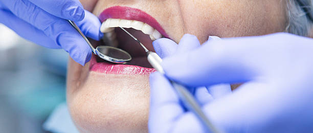 Best Dentist for Tooth Abscess  in Madisonville, KY
